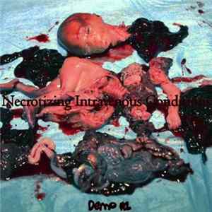 Necrotizing Intravenous Conditions - Demo #1 flac