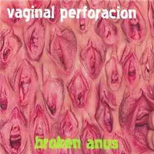 Vaginal Perforacion - Broken Anus flac
