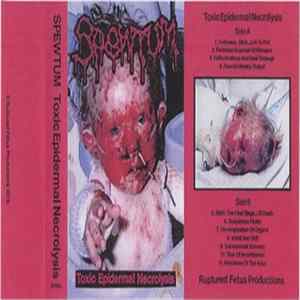 Spewtum - Toxic Epedermal Necrolysis flac