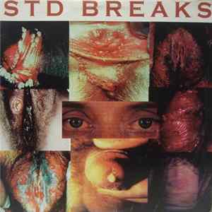 The Wax Fondler - STD Breaks flac