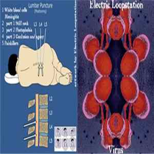 Electric Loopstation - Virus flac