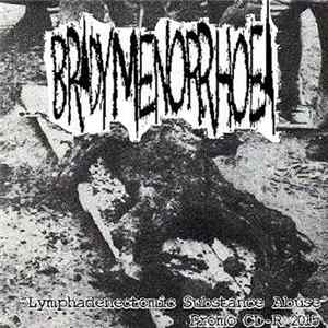 Bradymenorrhoea - Lymphadenectomic Substance Abuse flac