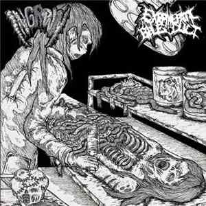 Extrahepatic Bile Duct, Ingrown - Dissecting A Fetid Infected Cadaver flac