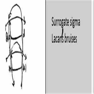 Surrogate sigma - Lacan’s Bruises flac